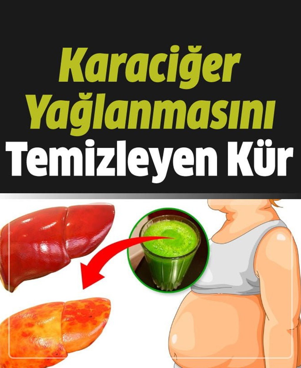 Karaciğer Yağlanmasını Kısa Sürede Temizleyen Doğal Kür - 1