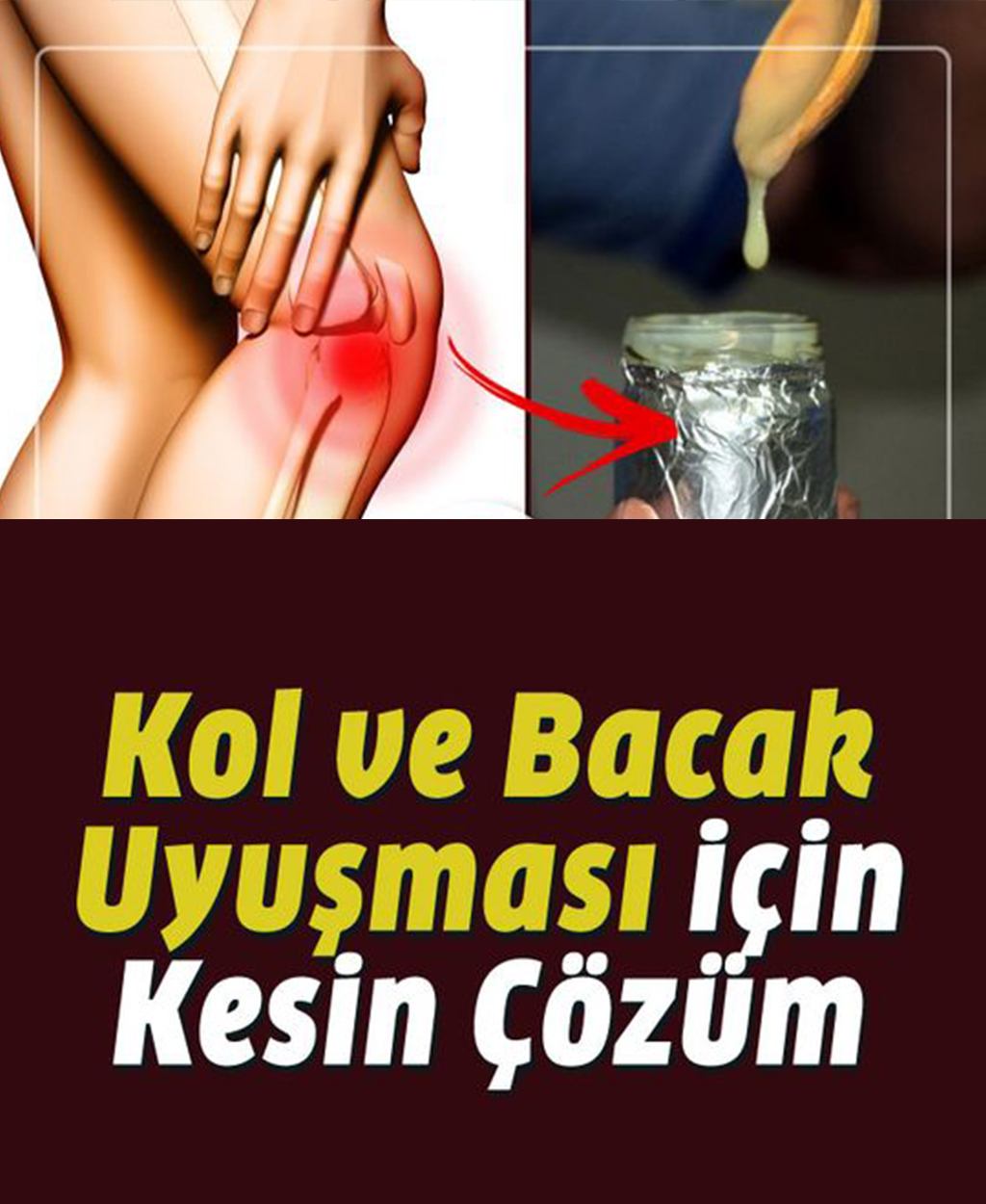 Kol ve bacak uyuşması neden olur, neyin belirtisi? - 1