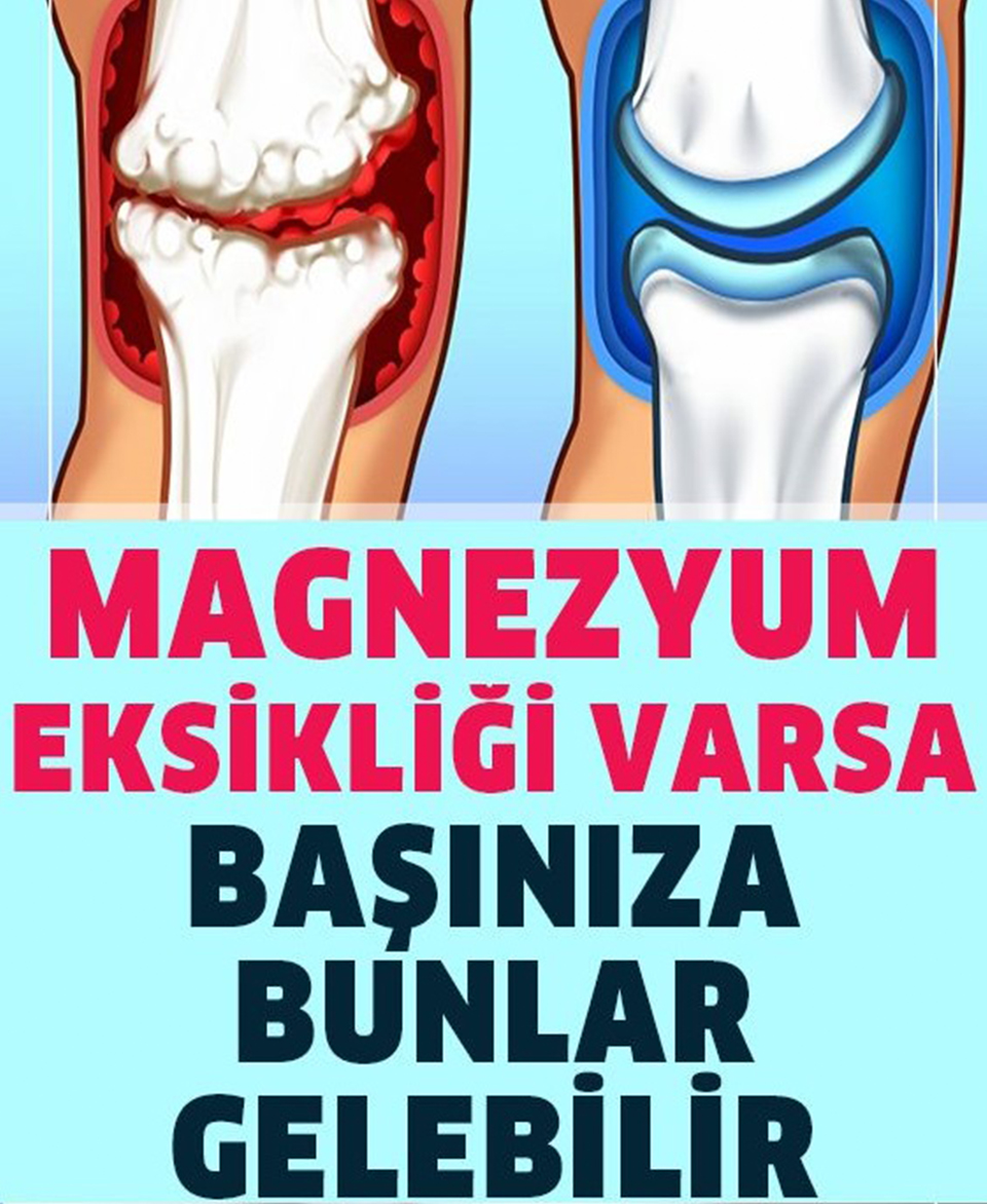 Vücudunuzda Magnezyum Eksikliğinin 13 Belirtisi - 1