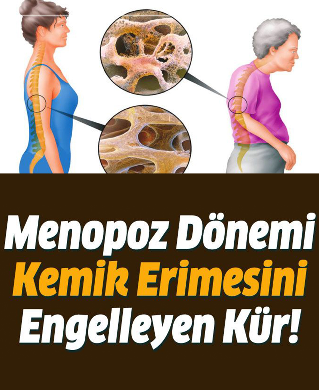 Menopoz Dönemi Kemik Erimesini Engelleyen Kür  - 1