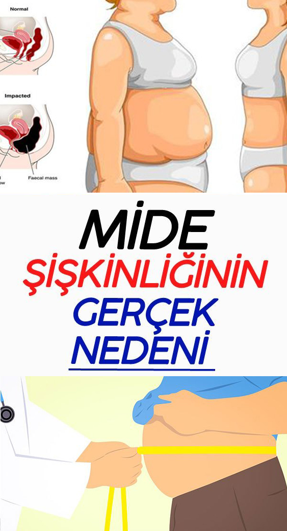 Mide Şişkinliğinin Gerçek Nedeni - 1