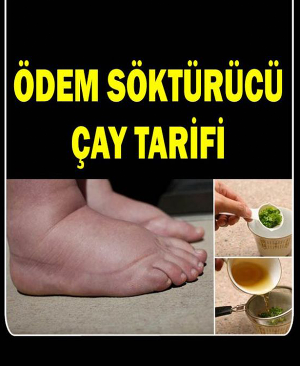 Ödem Söktürücü Çay Tarifi - 1