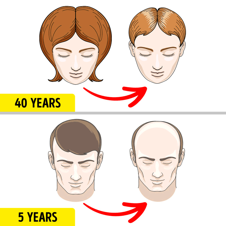 Erkeklerde ve kadınlarda görülen 8 farklı hastalığın farklı semptomları - 2