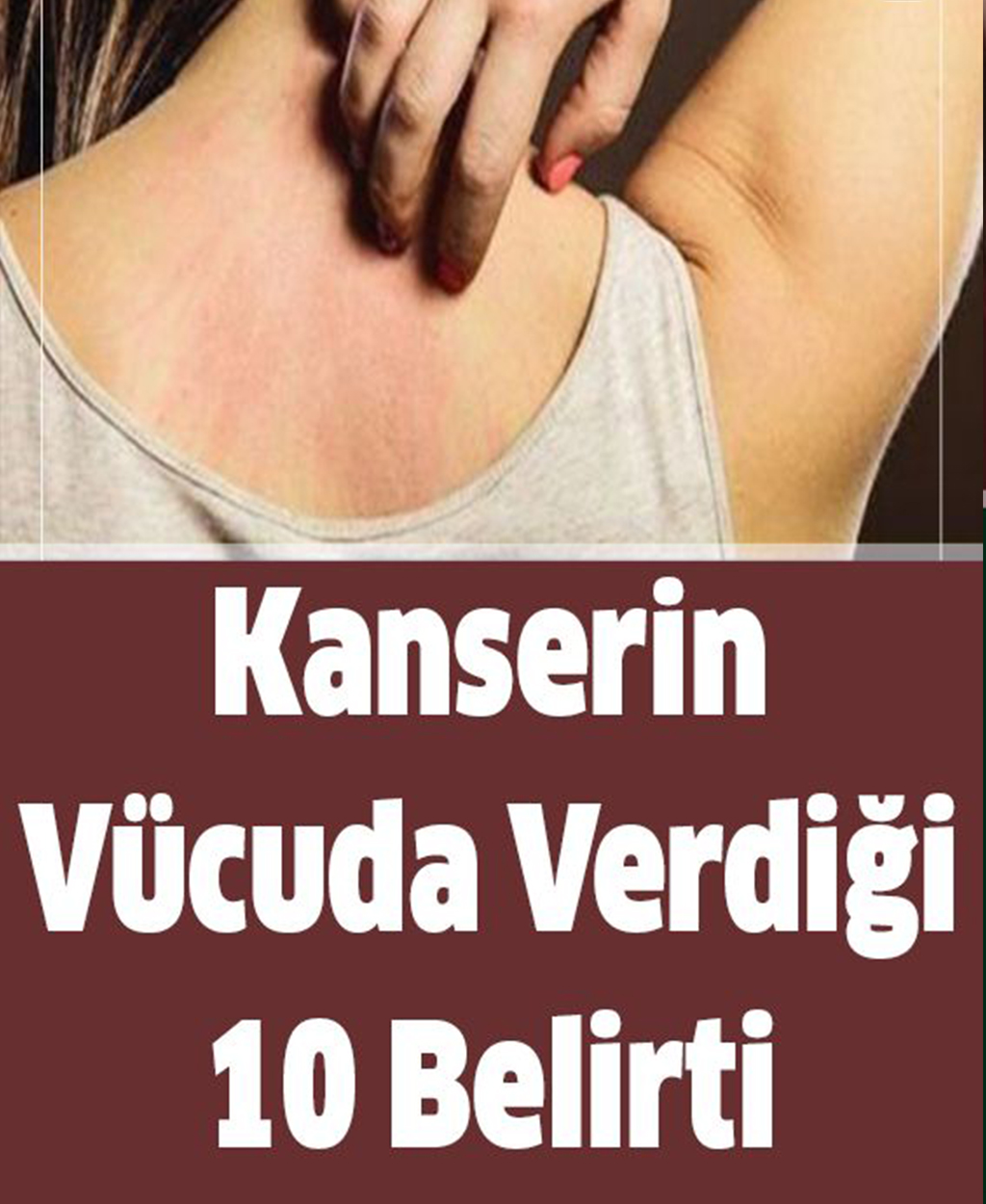 Kanserin Vücuda Verdiği 10 Belirti - 1