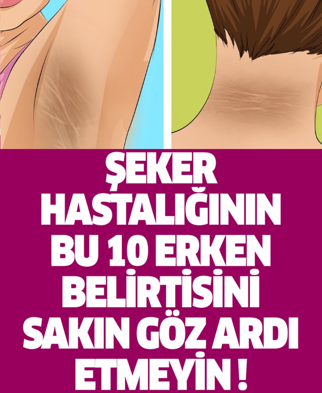 Şeker Hastalığının Bu 10 Erken Belirtisini Sakın Göz Ardı Etmeyin - 1