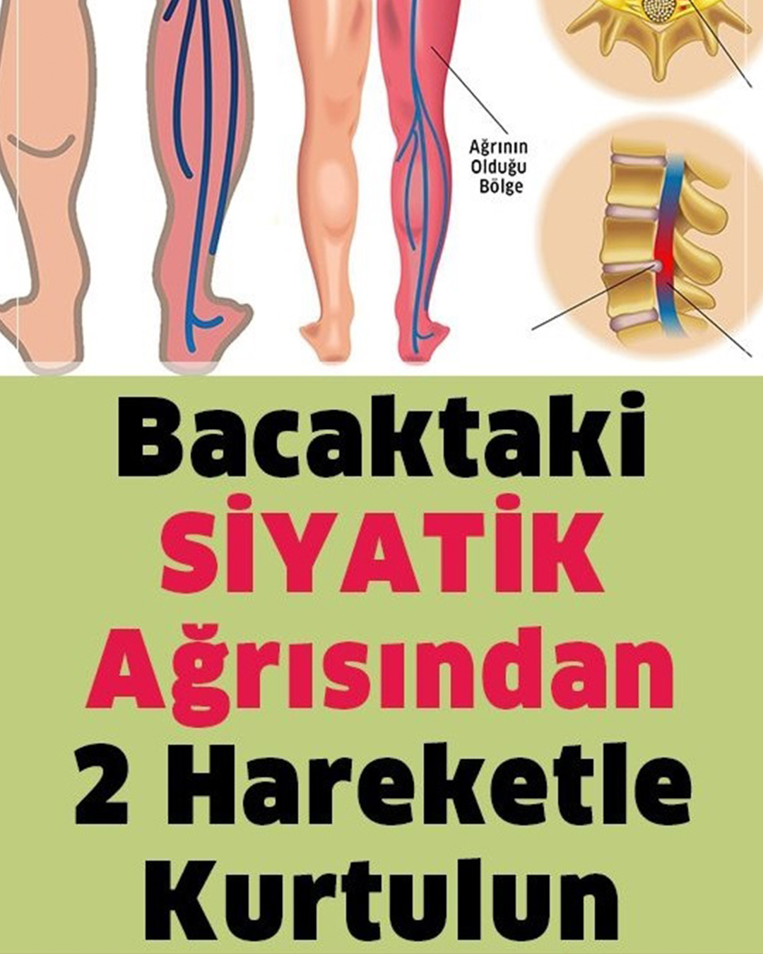 Siyatik Ağrısını Geçiren 2 Hareket - 1