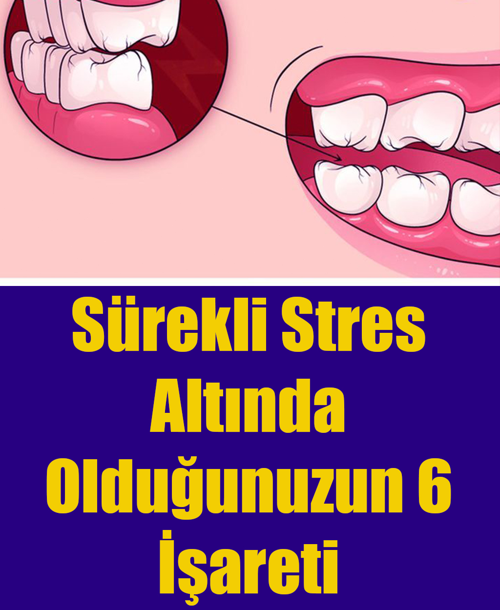 Sürekli Stres Altında Olduğunuzun 6 İşareti - 1