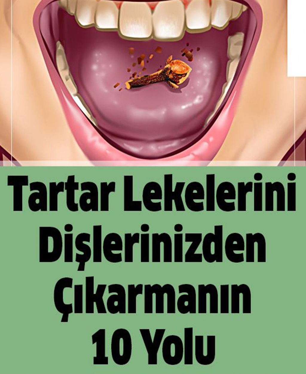 Tartar Lekelerini Dişlerinizden Çıkarmanın 10 Yolu - 1