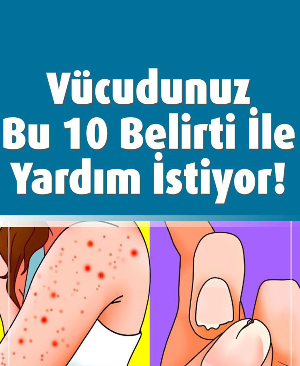 Vücudunuz Bu 10 Belirti İle Yardım İstiyor - 1