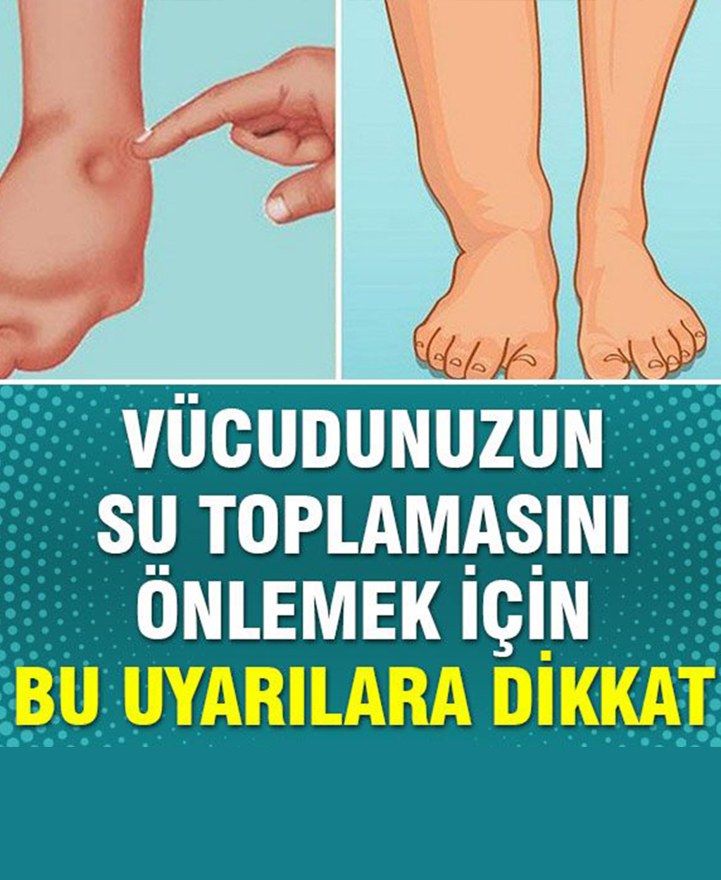 Vücudunuz Su Toplamasını Önlemek İçin Bu Uyarılara Dikkat - 1