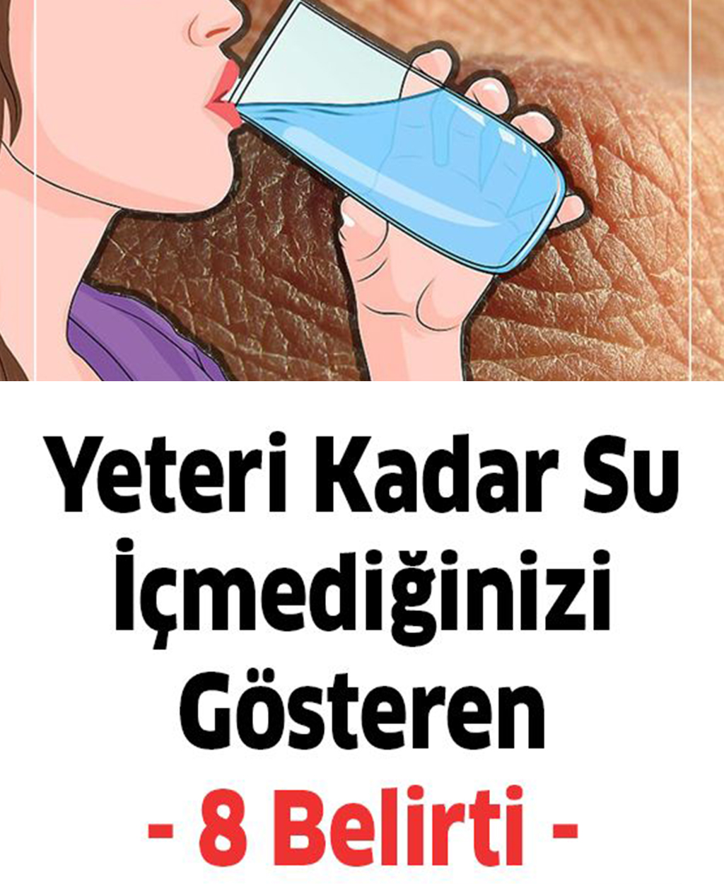 Yeteri kadar su içmediğinizde başınıza bunlar gelir - 1