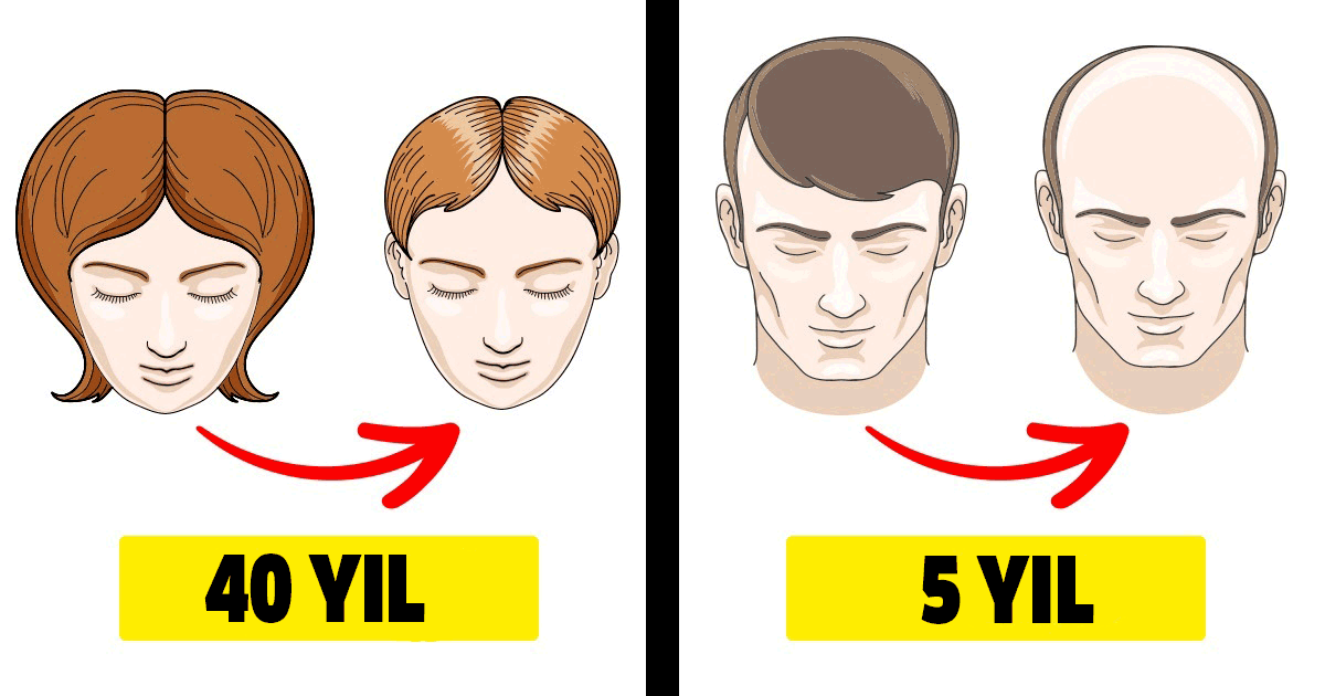 Erkeklerde ve kadınlarda görülen 8 farklı hastalığın farklı semptomları - 5